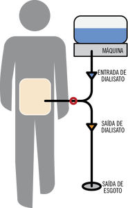 diálise-peritoneal-automática.png